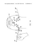 SURGICAL THREADING DEVICE AND METHOD FOR USING SAME diagram and image