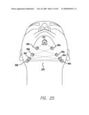 SURGICAL THREADING DEVICE AND METHOD FOR USING SAME diagram and image