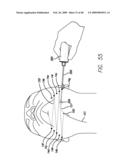 SURGICAL THREADING DEVICE AND METHOD FOR USING SAME diagram and image