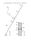 SURGICAL THREADING DEVICE AND METHOD FOR USING SAME diagram and image