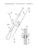 SURGICAL THREADING DEVICE AND METHOD FOR USING SAME diagram and image