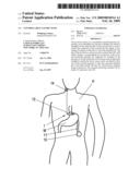 Controllable Gastric Band diagram and image