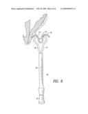 OBSTRUCTION OF UTERINE ARTERIES TO TREAT UTERINE FIBROIDS USING MECHANICAL INSTRUMENTS TO TWIST THE VESSELS diagram and image