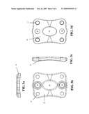 Anterior cervical staple diagram and image