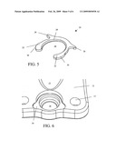 Anterior cervical staple diagram and image