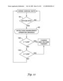 Method for Discriminating Between Ventricular and Supraventricular Arrhythmias diagram and image