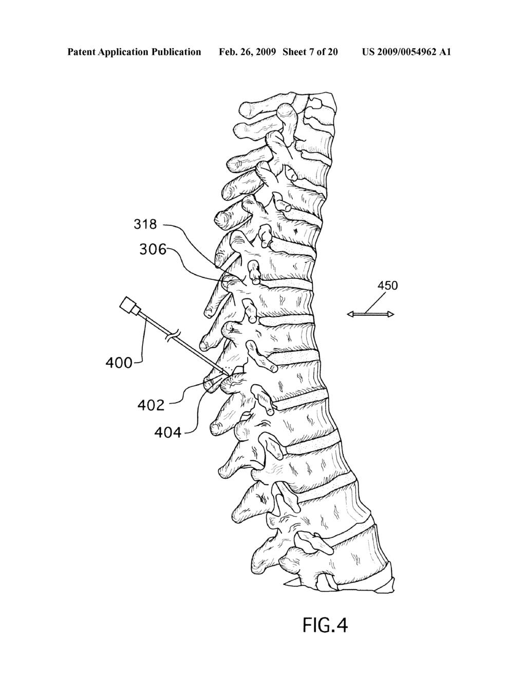 METHODS FOR TREATING THE THORACIC REGION OF A PATIENT'S BODY - diagram, schematic, and image 08