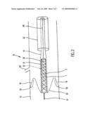 IMPLANT IMPLANTATION UNIT AND PROCEDURE FOR IMPLANTING THE UNIT diagram and image