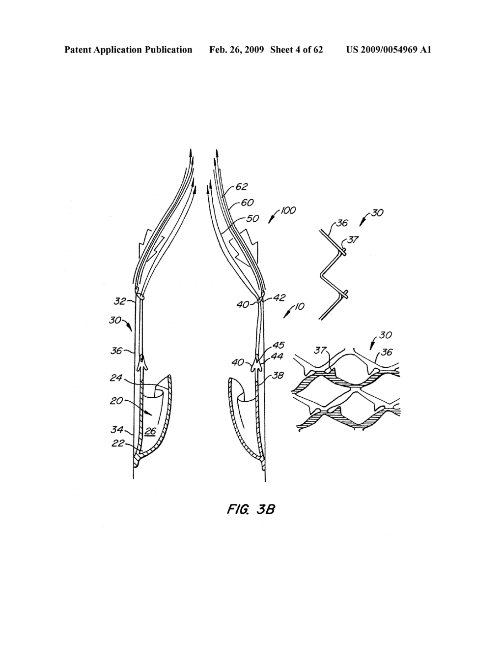 Repositionable Heart Valve and Method - diagram, schematic, and image 05