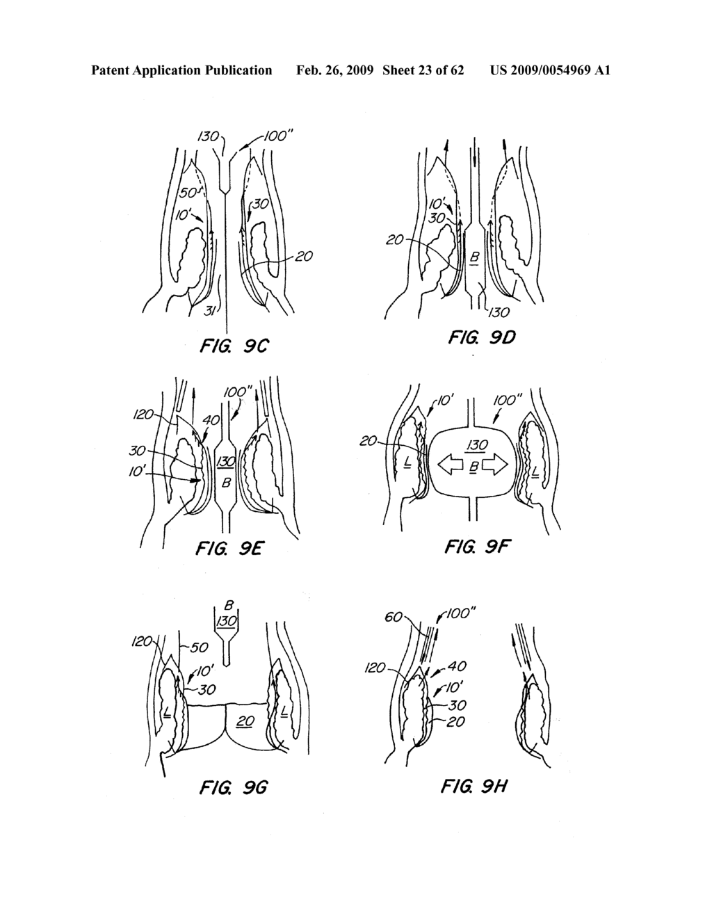 Repositionable Heart Valve and Method - diagram, schematic, and image 24