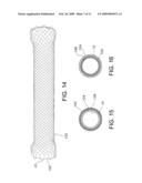 ATRAUMATIC STENT WITH REDUCED DEPLOYMENT FORCE, METHOD FOR MAKING THE SAME AND METHOD AND APPARATUS FOR DEPLOYING AND POSITIONING THE STENT diagram and image