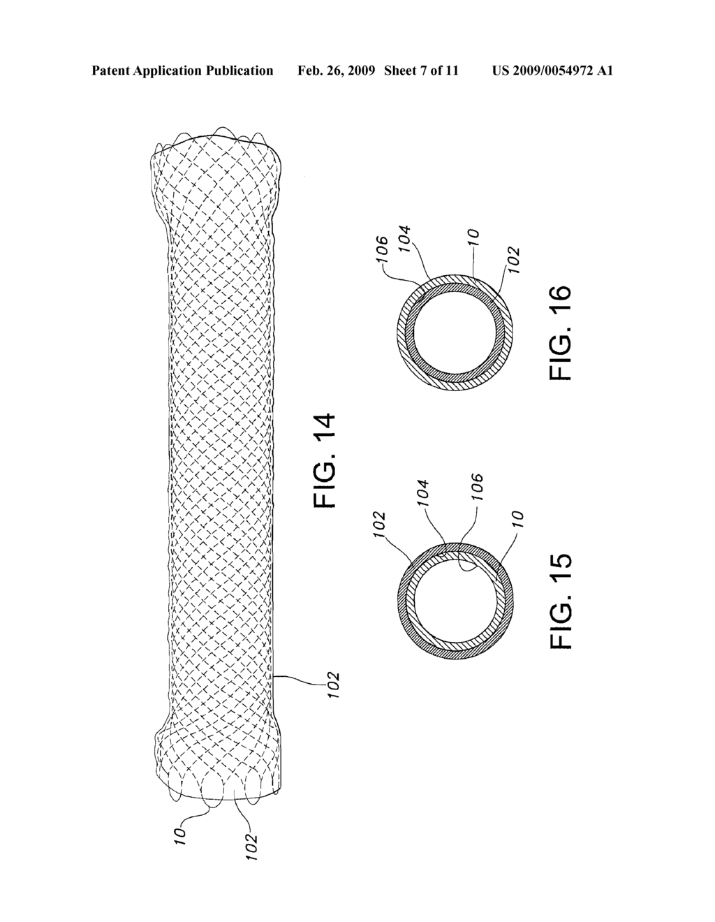 ATRAUMATIC STENT WITH REDUCED DEPLOYMENT FORCE, METHOD FOR MAKING THE SAME AND METHOD AND APPARATUS FOR DEPLOYING AND POSITIONING THE STENT - diagram, schematic, and image 08