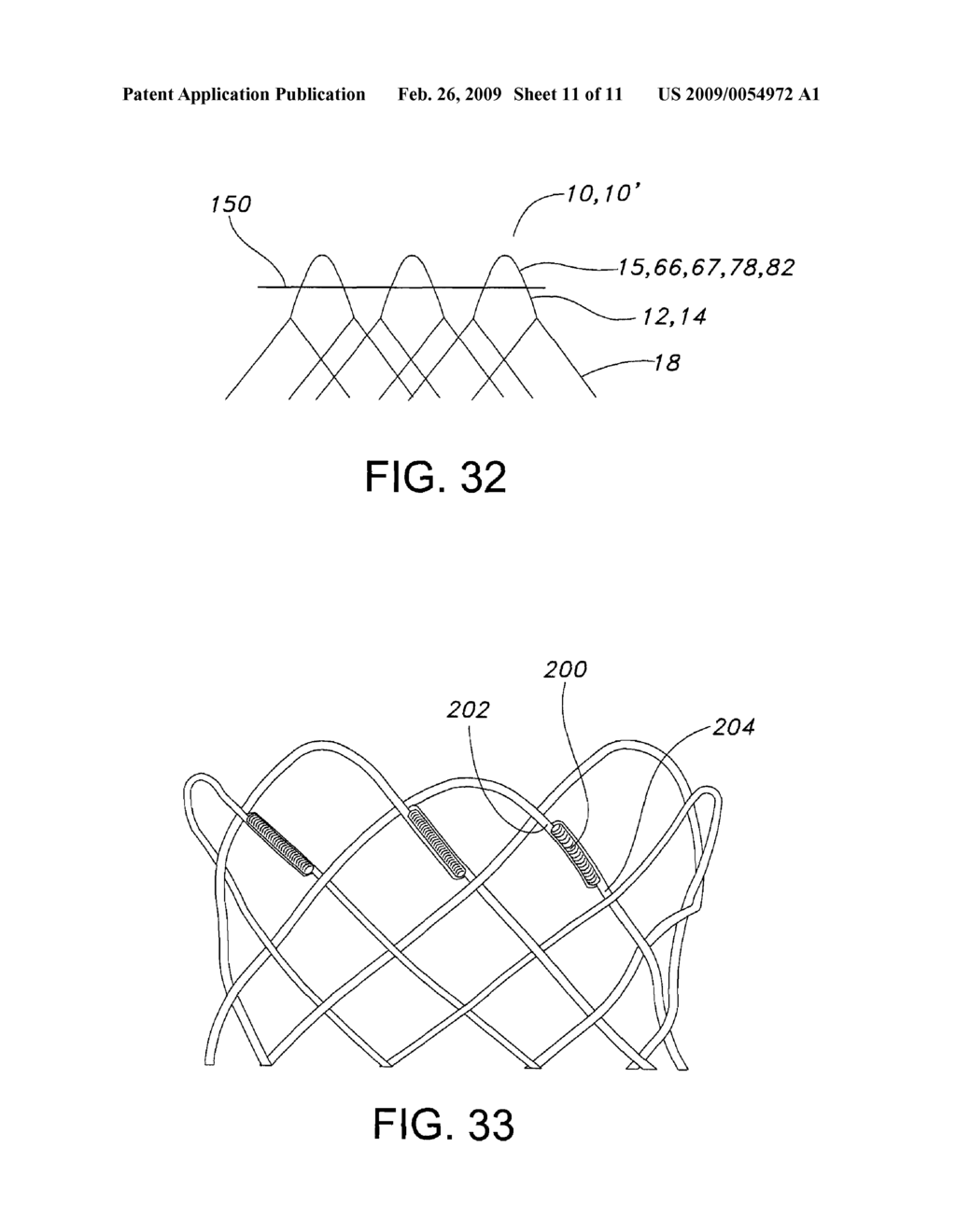 ATRAUMATIC STENT WITH REDUCED DEPLOYMENT FORCE, METHOD FOR MAKING THE SAME AND METHOD AND APPARATUS FOR DEPLOYING AND POSITIONING THE STENT - diagram, schematic, and image 12