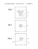 INTERVENTIONAL MEDICAL DEVICE FOR USE IN MRI diagram and image