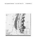 INTERVENTIONAL MEDICAL DEVICE FOR USE IN MRI diagram and image