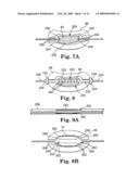 MULTI-LUMEN MOLD FOR INTERVERTEBRAL PROSTHESIS AND METHOD OF USING SAME diagram and image