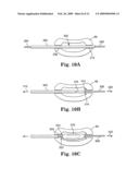 MULTI-LUMEN MOLD FOR INTERVERTEBRAL PROSTHESIS AND METHOD OF USING SAME diagram and image