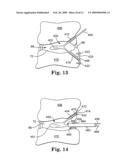 MULTI-LUMEN MOLD FOR INTERVERTEBRAL PROSTHESIS AND METHOD OF USING SAME diagram and image