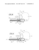 TRANSFORAMINAL LUMBAR INTERBODY FUSION CAGE diagram and image