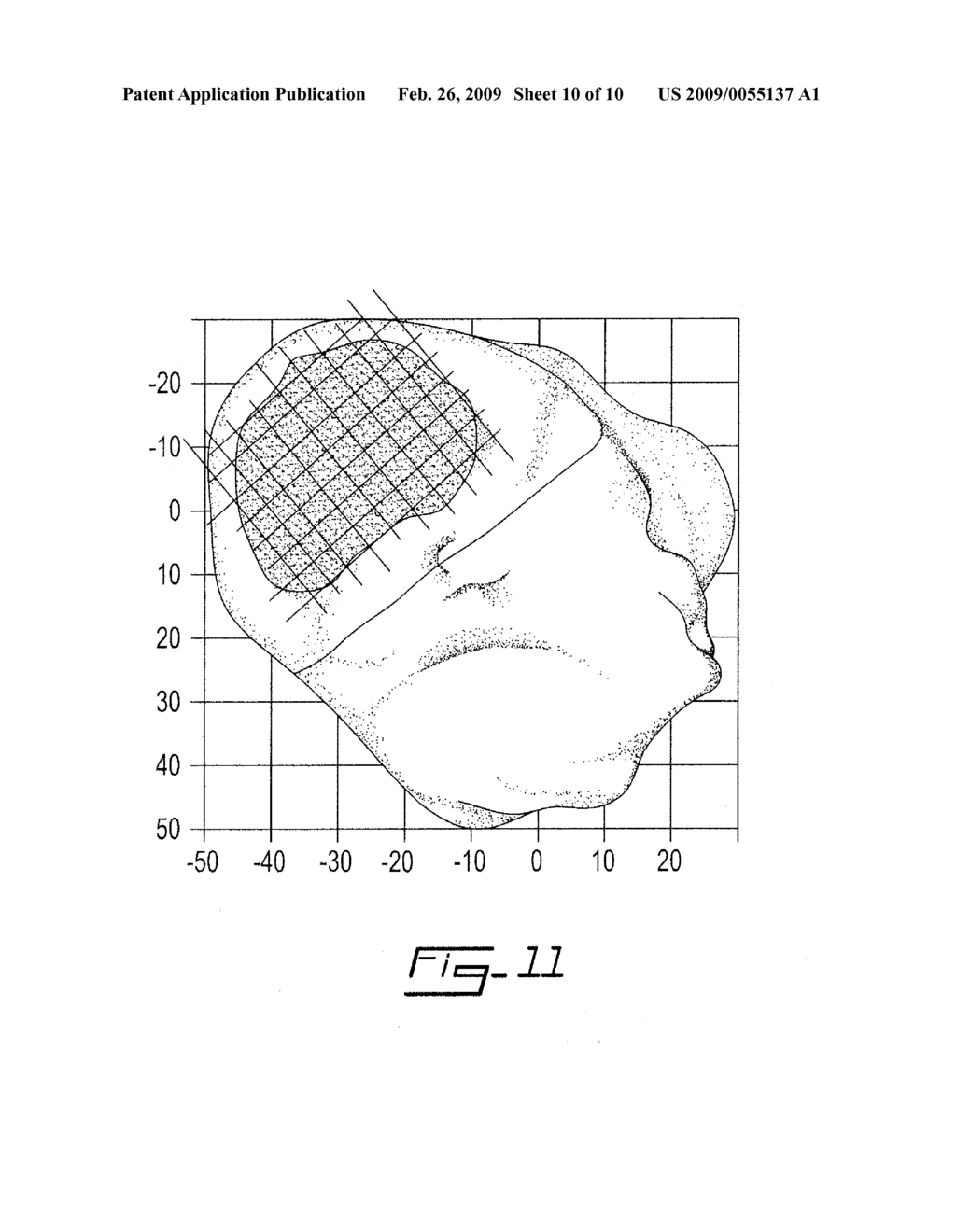 METHOD FOR OBTAINING GEOMETRIC PROPERTIES OF AN ANATOMIC PART - diagram, schematic, and image 11