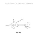 METHODS AND DEVICES FOR OCCLUDING AN OVARIAN PATHWAY diagram and image