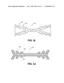 METHODS AND DEVICES FOR OCCLUDING AN OVARIAN PATHWAY diagram and image