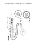 METHODS AND DEVICES FOR OCCLUDING AN OVARIAN PATHWAY diagram and image