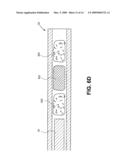 METHODS AND DEVICES FOR OCCLUDING AN OVARIAN PATHWAY diagram and image