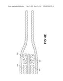 METHODS AND DEVICES FOR OCCLUDING AN OVARIAN PATHWAY diagram and image