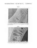 Filtration Membrane diagram and image