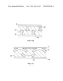 Component with a damping filler diagram and image