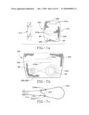 Knee Air Bag Module and Method of Assembly diagram and image