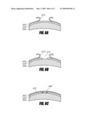 SYSTEM AND METHOD FOR INCREASING THE DEPTH FOCUS OF THE HUMAN EYE diagram and image