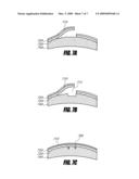 SYSTEM AND METHOD FOR INCREASING THE DEPTH FOCUS OF THE HUMAN EYE diagram and image