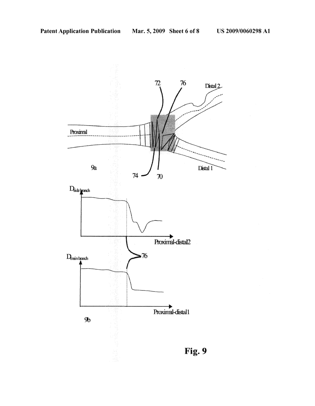 Method, Apparatus and Computer Program for Quantitative Bifurcation Analysis on Angiographic Images - diagram, schematic, and image 07