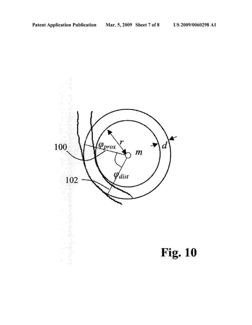 Method, Apparatus and Computer Program for Quantitative Bifurcation Analysis on Angiographic Images - diagram, schematic, and image 08