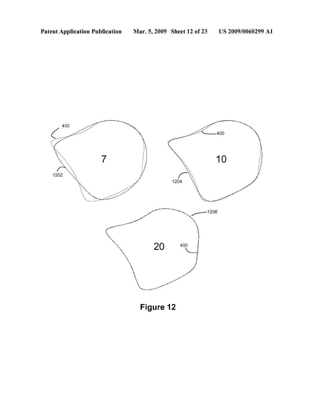 Method and Apparatus for Efficient Three-Dimensional Contouring of Medical Images - diagram, schematic, and image 13