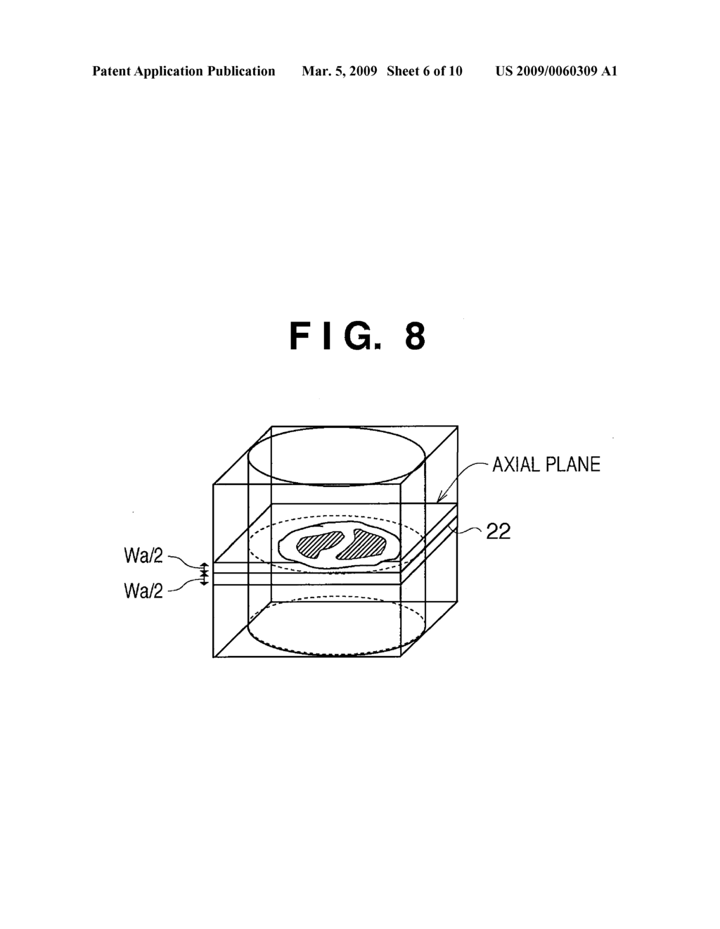 RADIATION IMAGE PROCESSING APPARATUS AND METHOD THEREOF - diagram, schematic, and image 07