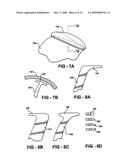 Expandable impeller pump diagram and image