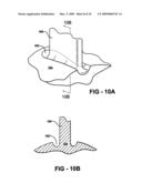 Expandable impeller pump diagram and image