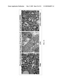 Novel synthetic triterpenoids and methods of use in the treatment and prevention of multiple scleroris diagram and image