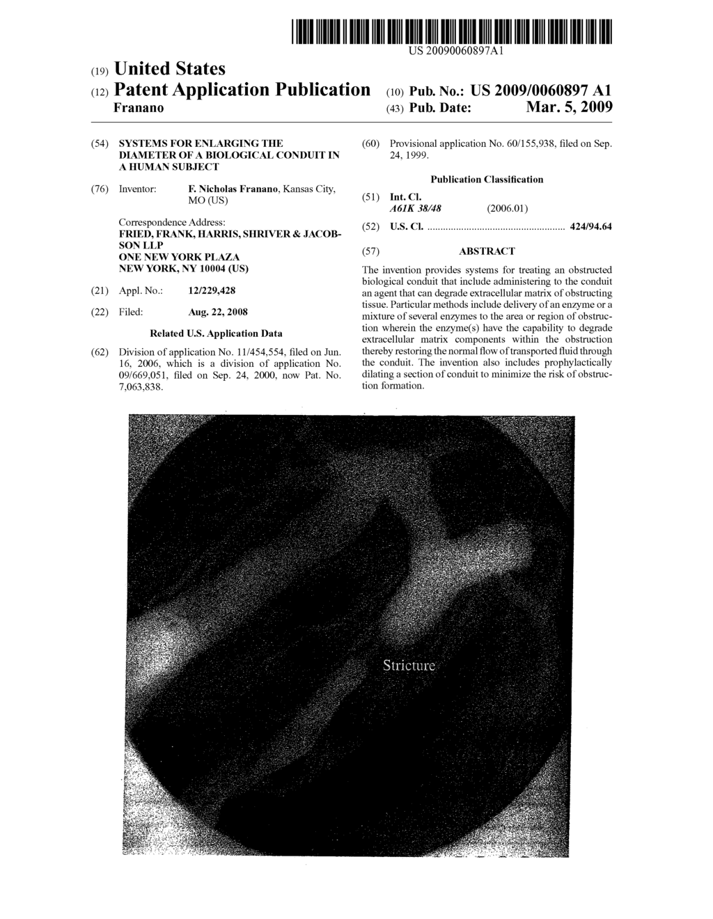 Systems for enlarging the diameter of a biological conduit in a human subject - diagram, schematic, and image 01