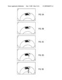 CONTAINMENT SYSTEM FOR DELIVERY OF BIOLOGICAL PRODUCTS AND METHOD OF SURGERY diagram and image