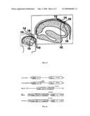 DEVICES, SYSTEMS AND METHODS FOR IMPROVING MEMORY AND/OR COGNITIVE FUNCTION THROUGH BRAIN DELIVERY OF SIRNA diagram and image