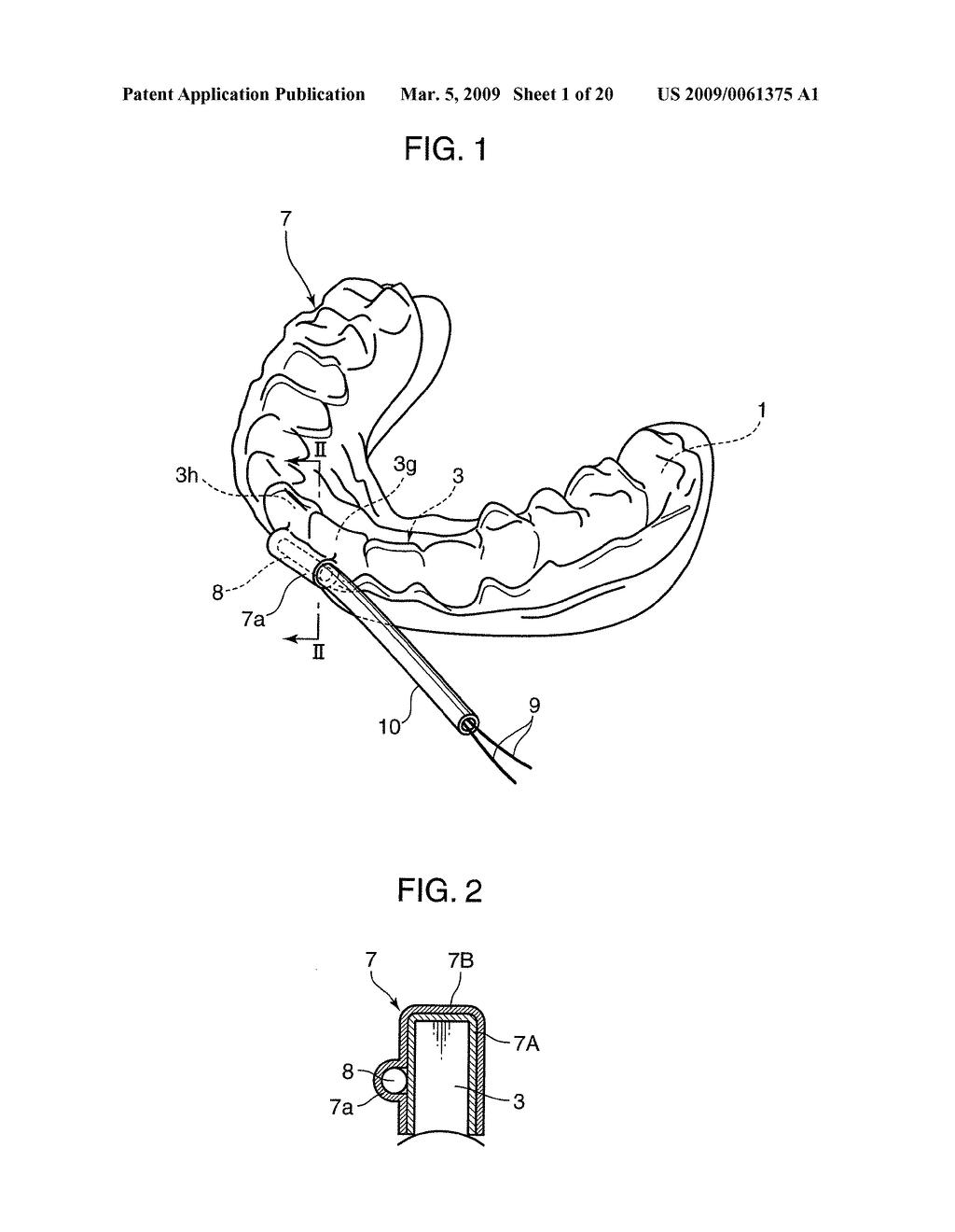 ORTHODONTIC APPLIANCE - diagram, schematic, and image 02