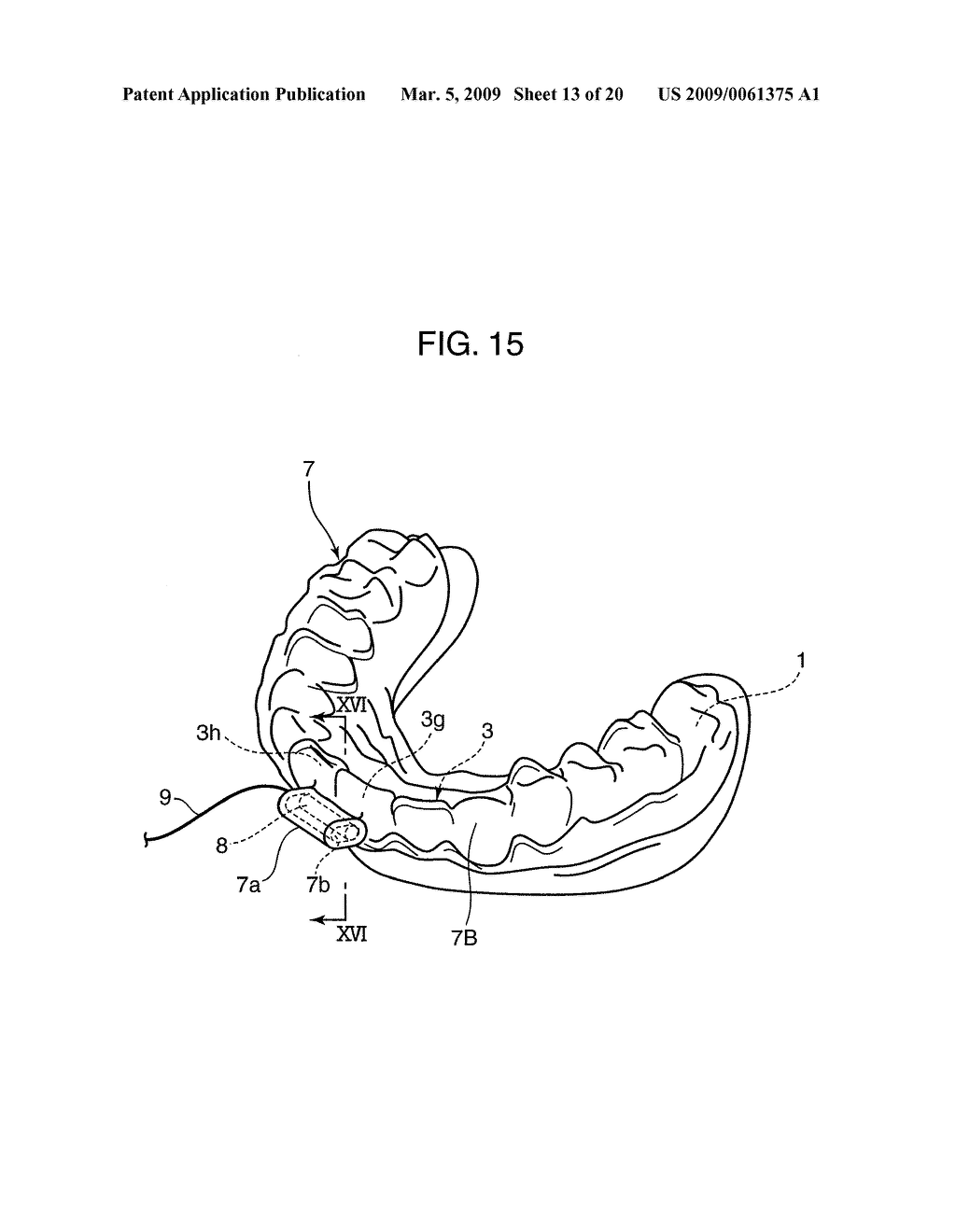 ORTHODONTIC APPLIANCE - diagram, schematic, and image 14