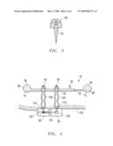 PREFABRICATED ADJUSTABLE IMPLANT-BASED TOOTH MOVEMENT DEVICE diagram and image