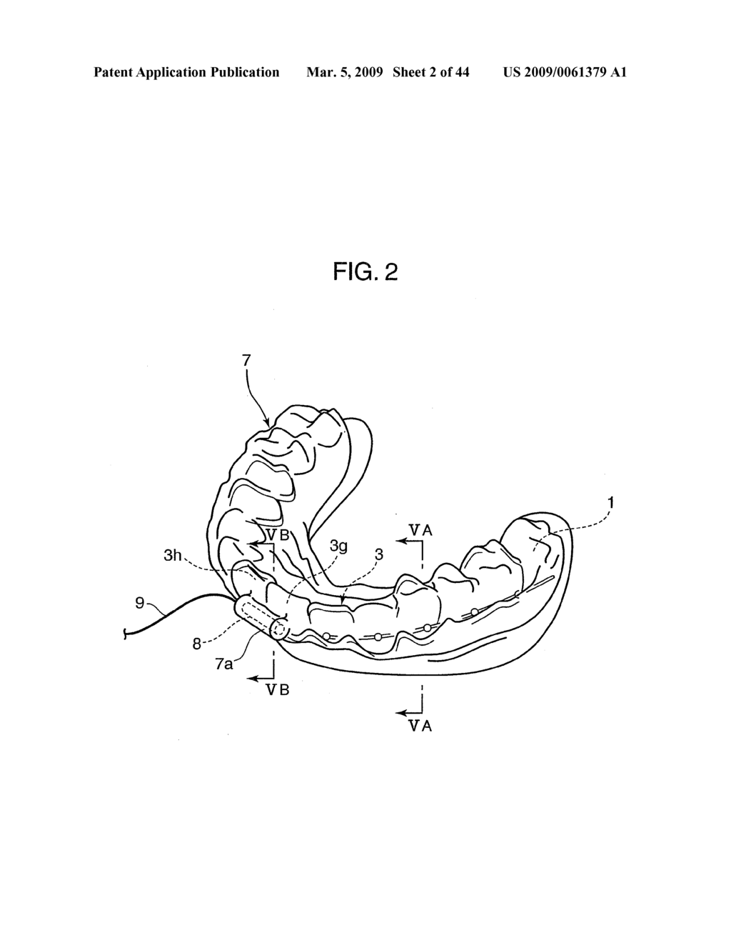 Orthodontic Appliance - diagram, schematic, and image 03