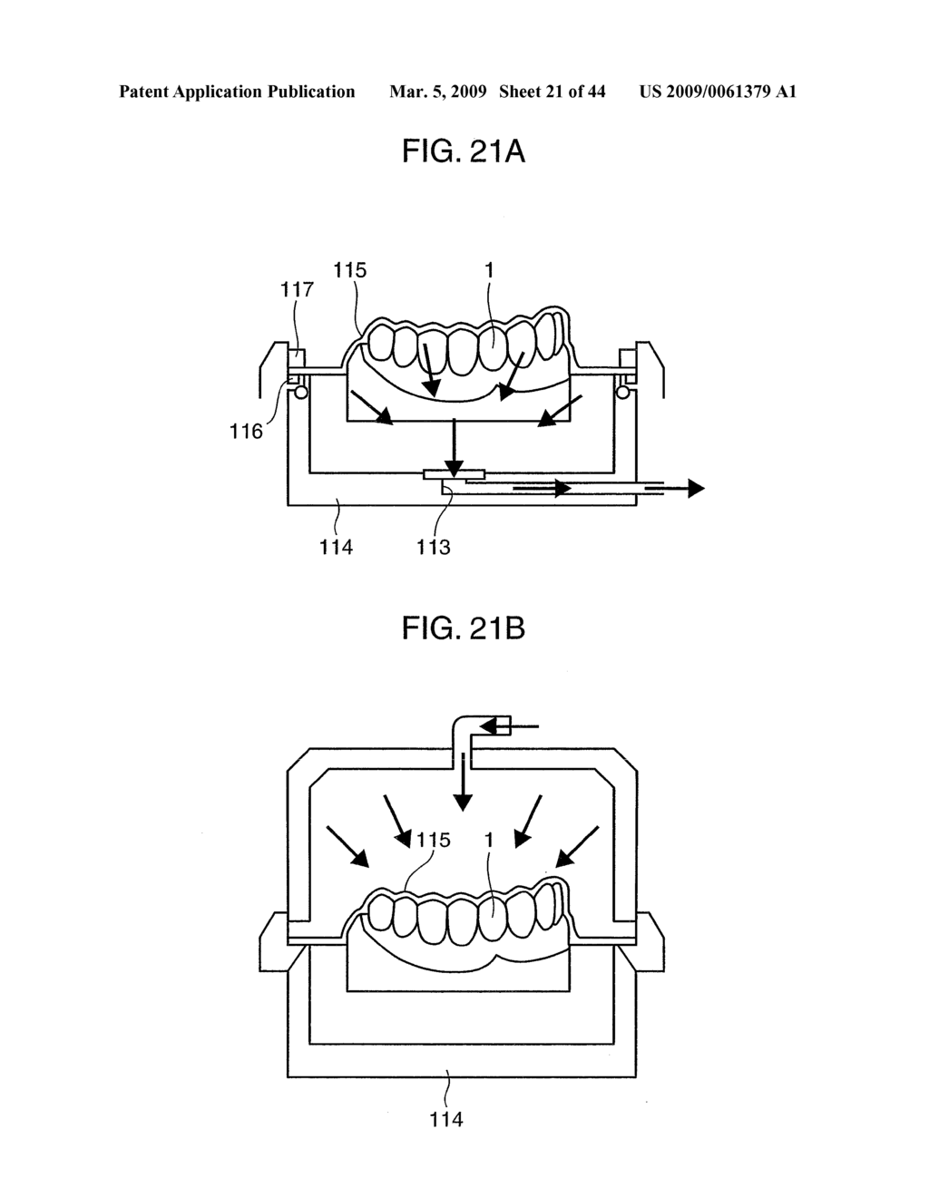 Orthodontic Appliance - diagram, schematic, and image 22