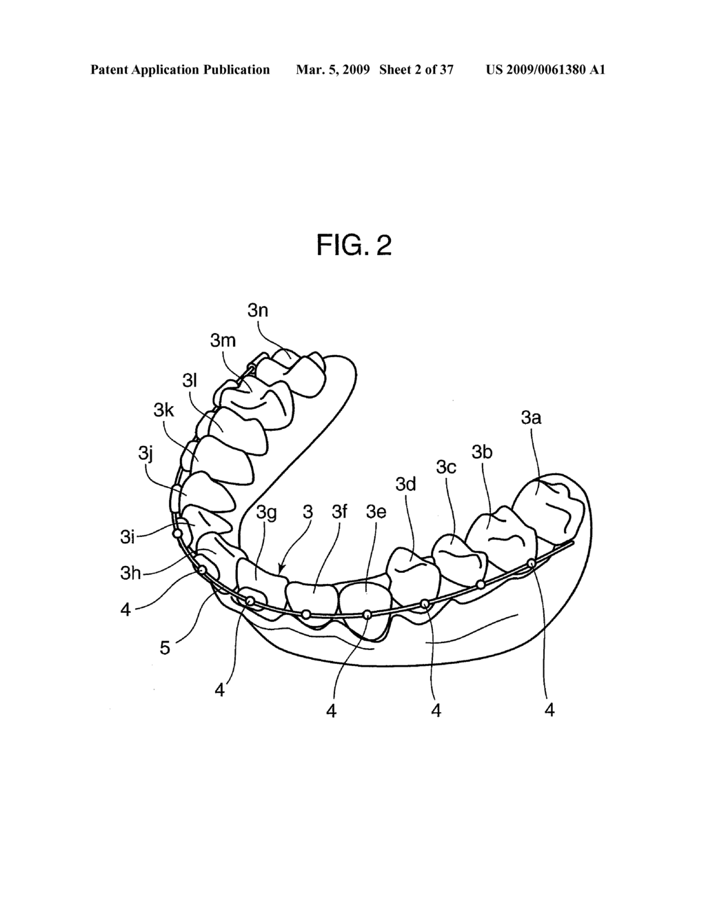 ORTHODONTIC APPLIANCE - diagram, schematic, and image 03